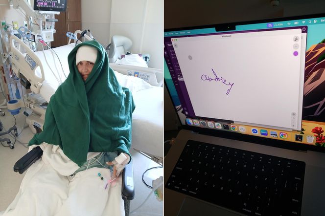 Przełom w medycynie? Sparaliżowana kobieta z chipem w mózgu pisze i rysuje