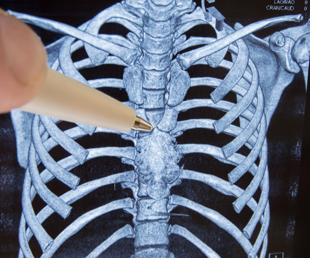 Ten organ miał być bezużyteczny. Lekarze usuwali coś, co może chronić przed rakiem