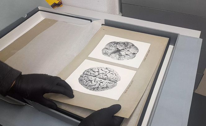 Tajemnica mózgu Piłsudskiego. Nieznany album w archiwach