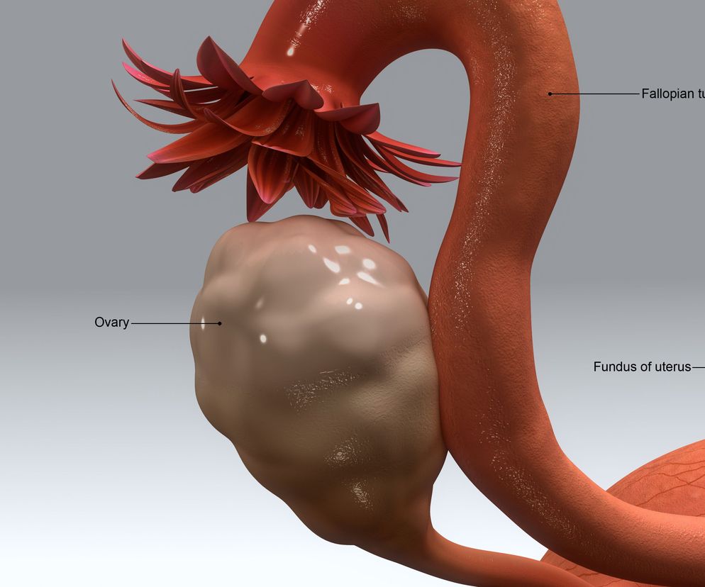 Ropień jajnika lub jajowodu to jeden z ostrych stanów w ginekologii, który wymaga natychmiastowej interwencji.