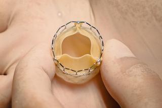 Na urodziny dostałem zastawkę z wołu 