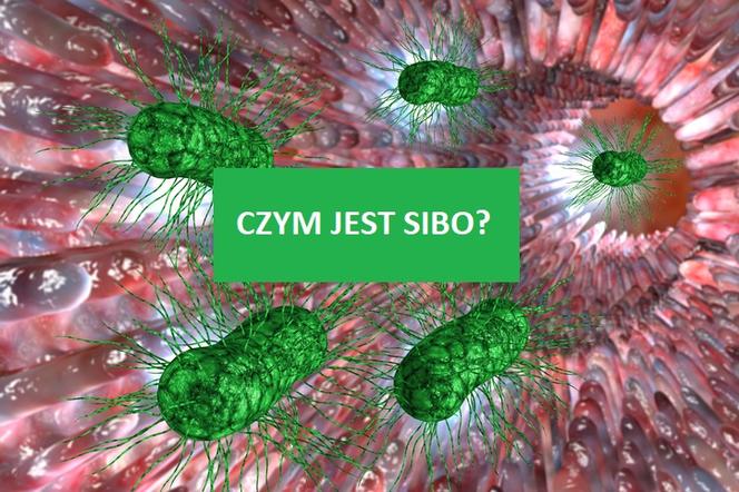 SIBO