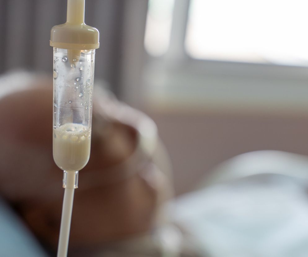 Żywienie pozajelitowe - na czym polega? Wskazania do stosowania