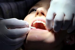 Gdzie tanio wyleczyć zęby w Szczecinie? Studenci PUM zapraszają pacjentów w różnym wieku! [AUDIO]