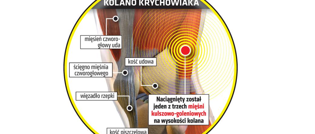 Grzegorz Krychowiak, kontuzja, infofrafika