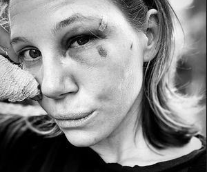 Córka Ryśka z Klanu miała poważny wypadek! Wstrząsające zdjęcia!