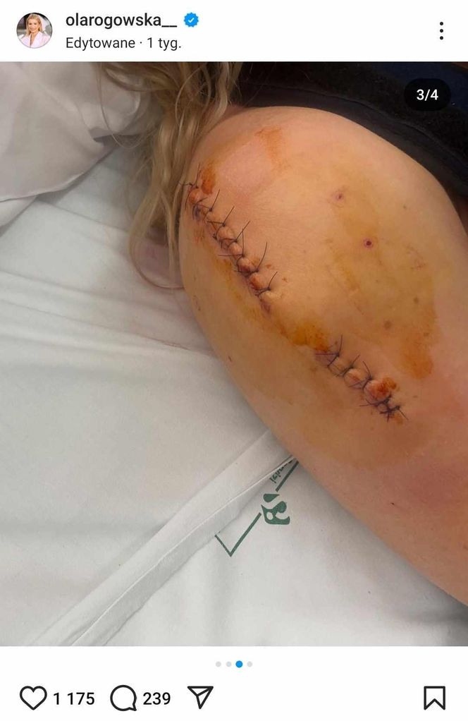 Aleksandra Rogowska-Lichnerowicz