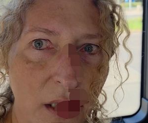 Zenobia broniła Ukrainki w autobusie w Warszawie. Została zaatakowana. „Krew polała się z nosa”