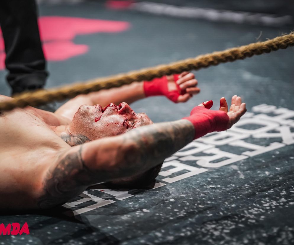 GROMDA 21: Zmasakrowana twarz Górala w walce