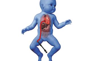 Naprawili serduszko 5-miesięcznej Mai