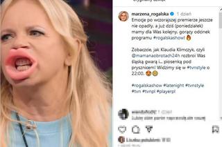 Ogromne usta Marzeny Rogalskiej! Co ona z sobą zrobiła?!