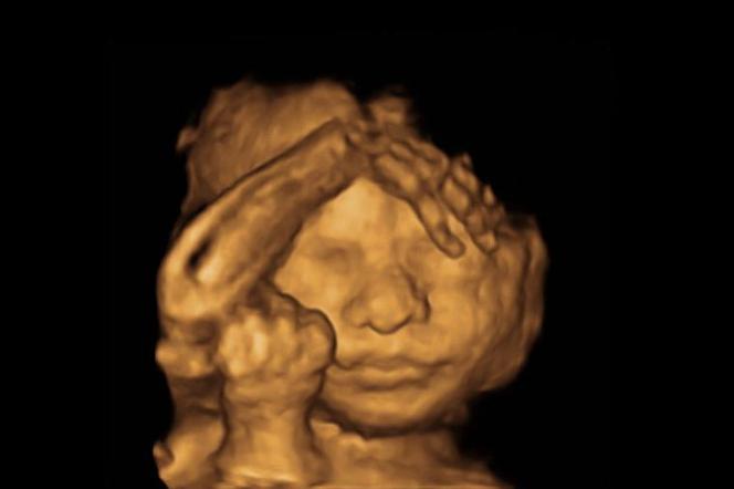 płód aborcja dziecko ciąża