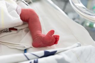 Na świat przyszło dziecko z trzema rękami. Dodatkowa kończyna wyrosła na plecach