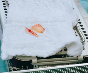 Lubelscy lekarze przeprowadzili pierwszą taką operację w Polsce!