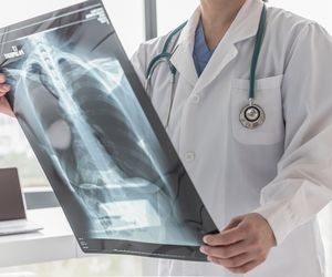 Klatka piersiowa - budowa, funkcje, choroby