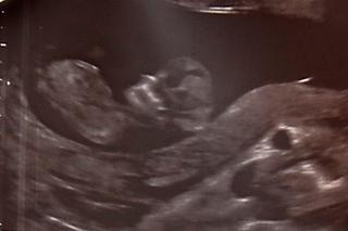 Przez lekarzy umarła mi córka, a teraz żona