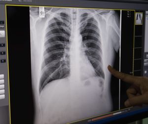 Brutalny napad na kontrolerkę biletów. Nastoletni pasażer uszkodził jej kręgosłup!