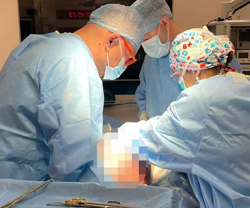 Ogromny guz jajnika usunięty w Centrum Onkologii w Bydgoszczy