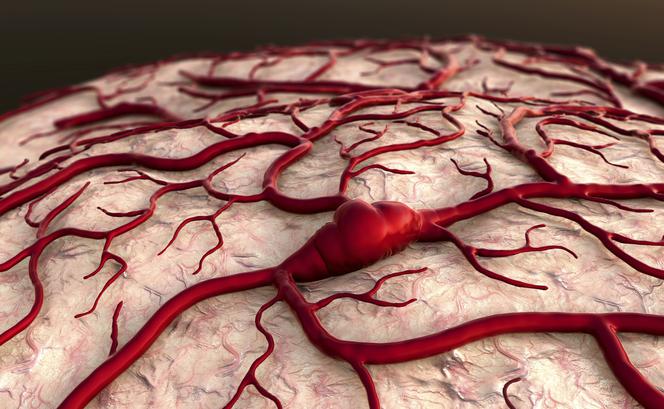 Zaburzenia krążenia krwi w mózgu: przyczyny i objawy