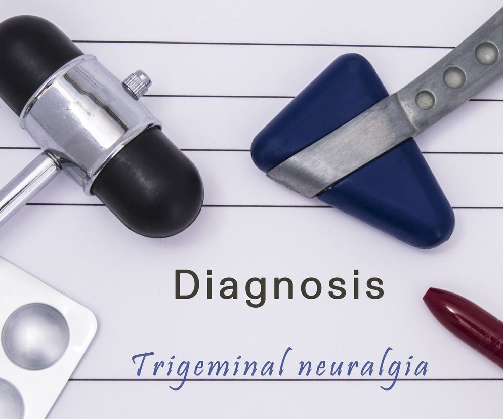 Neuralgia (nerwoból) nerwu trójdzielnego czyli rwa twarzowa, to napad ostrego bólu ograniczonego do okolicy czoła, policzka, nosa lub żuchwy.