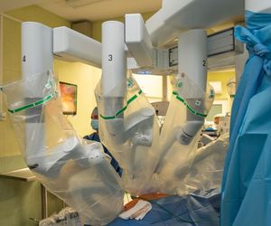 Sztuczna inteligencja przeprowadza operacje.