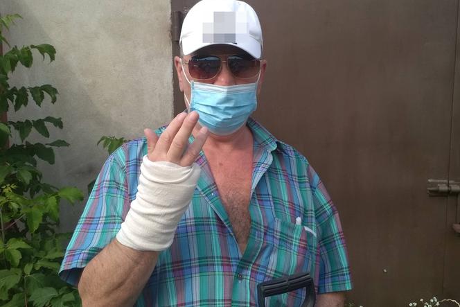 Klacz odgryzła mi palec