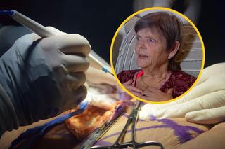 65-latka poddała się wygładzaniu skóry. Po zabiegu przeżyła prawdziwy horror!