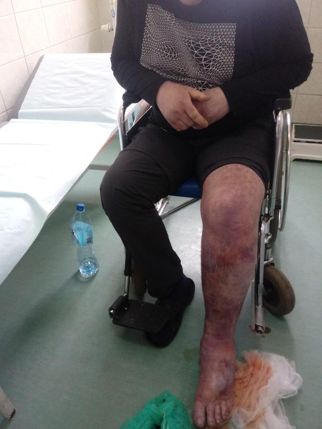Lekarze nic nie zrobili, pielęgniarka tylko zmywała krew