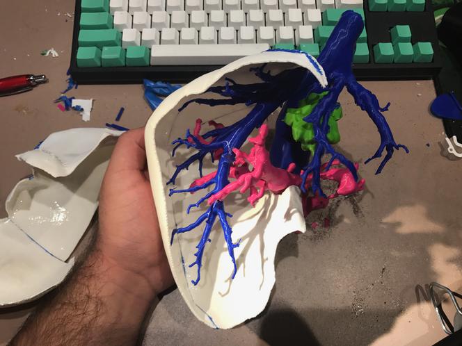 Student UJ drukuje modele wątroby w 3D. To jedyna taka metoda na świecie! [ZDJĘCIA, AUDIO]