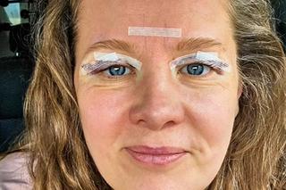 Anna Powierza poddała się drastycznemu zabiegowi