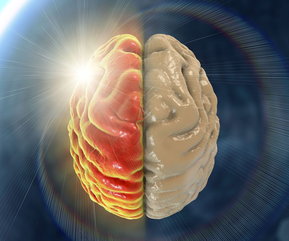 Wyróżniane są dwa rodzaje hemikranii - hemikrania napadowa oraz hemikrania ciągła.