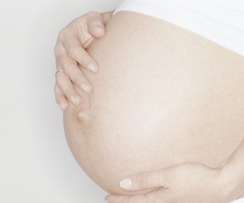 Rozstęp mięśni prostych brzucha - objawy i leczenie. Do jakiego lekarza się udać?