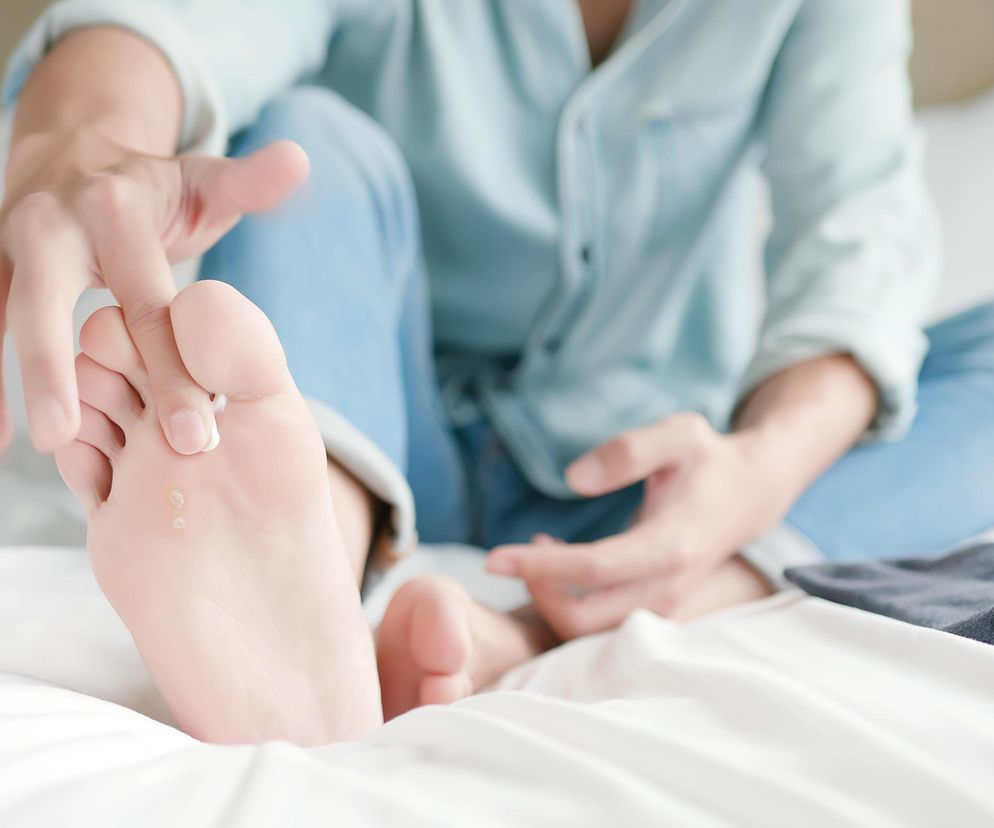 Leki bez recepty na grzybicę stóp. Szybka pomoc przy pierwszych objawach