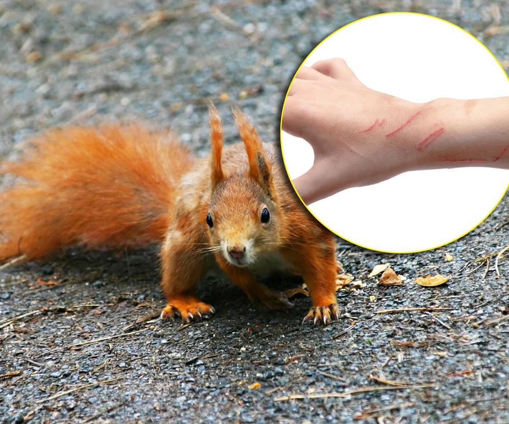 Prawie zabiła mnie wiewiórka. Dramatyczny atak, dwie osoby wylądowały w szpitalu