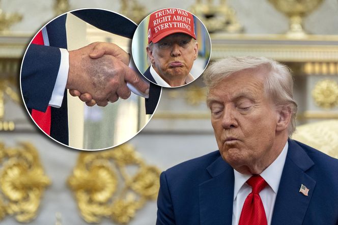 Donald Trump ma kłopoty ze zdrowiem. Nowe zdjęcia wywołały niepokój