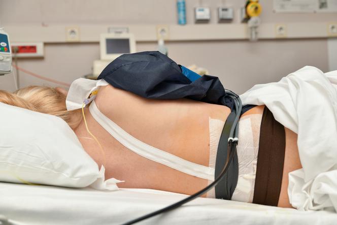 Obalamy mity dotyczące znieczulenia zewnatrzoponowego podczas porodu