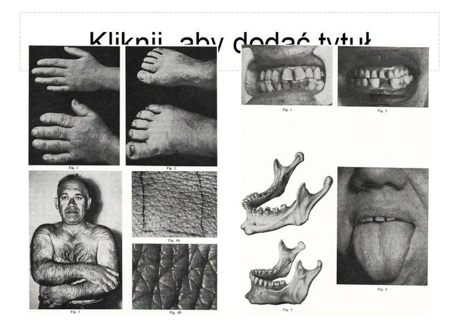 Boję się, że będę miała twarz giganta