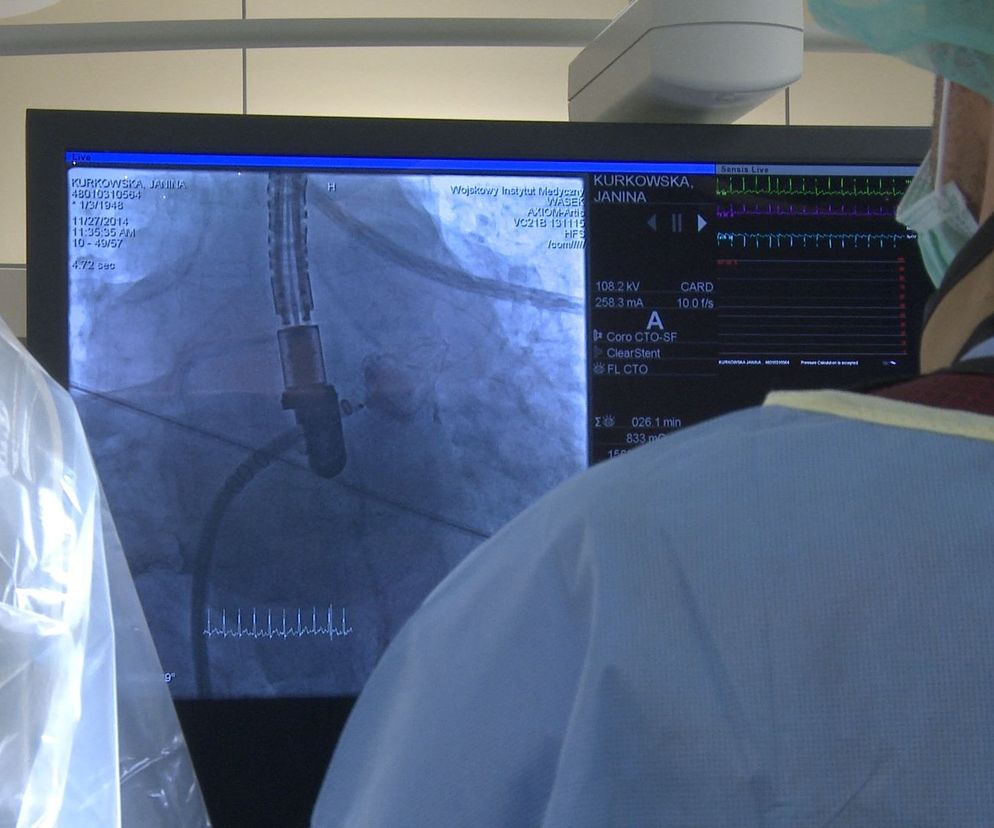 Krioablacja jest nowoczesną metodą leczenia migotania przedsionków serca.