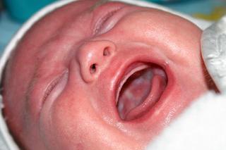 Twardy brzuszek u niemowlaka: przyczyny kolki u niemowlaka i sposoby jej łagodzenia