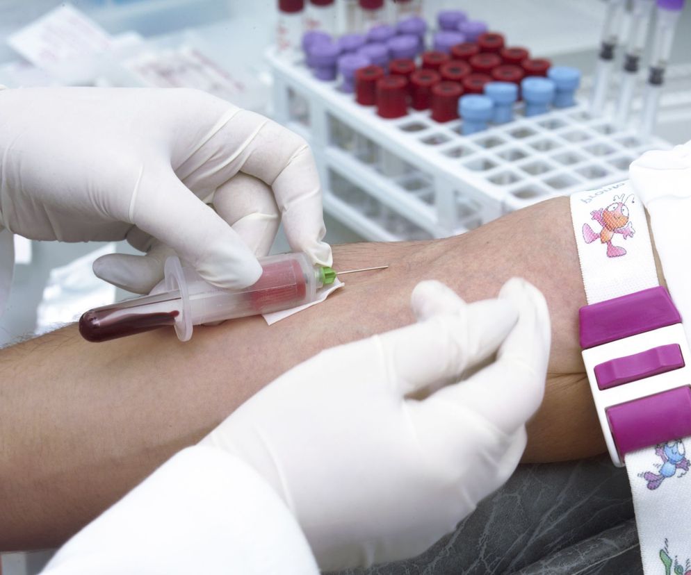 Profil kostny  to badania krwi, które pozwalają ocenić kondycję kości. Jakie są wskazania do wykonania profilu kostnego? Jakie są normy? Jak interpretować wyniki badań?