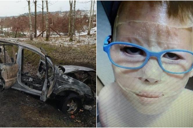 Auto spłonęło, 10-latek ciężko poparzony. Jego ciało pokryły przerażające blizny! [DRASTYCZNE ZDJĘCIA]
