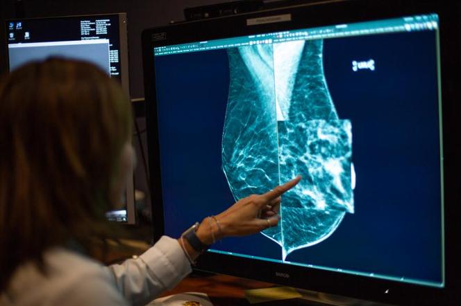 Mammografia dla iławianek bezpłatnie! I to bez skierowania