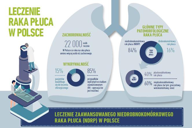 Liczy się czas w raku płuca