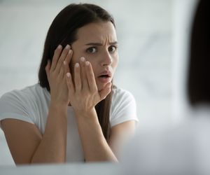 Zaczyna się od niepozornych plamek na skórze. Mięsak Kaposiego to nowotwór  złośliwy