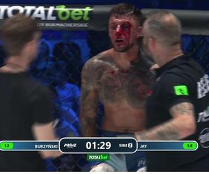 Zmasakrowana twarz gwiazdy PRIME MMA 9. To było bardzo brutalne! Walkę przerwał lekarz [ZDJĘCIE]