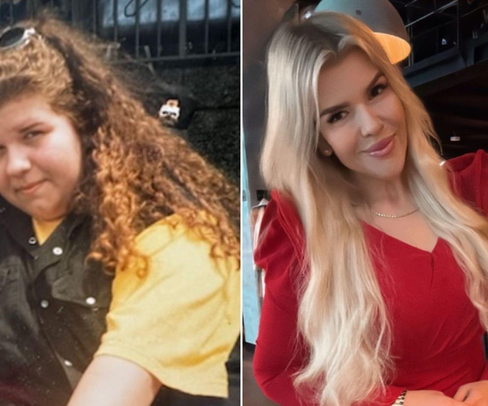 Polska instagramerka zrzuciła aż 100 kg. Teraz planuje operacje