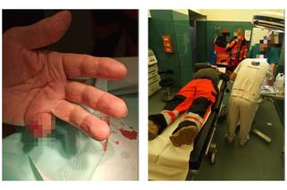 Medyka. Obywatel Turkmenistanu zaatakował ratownika. Odgryzł mu palec!  