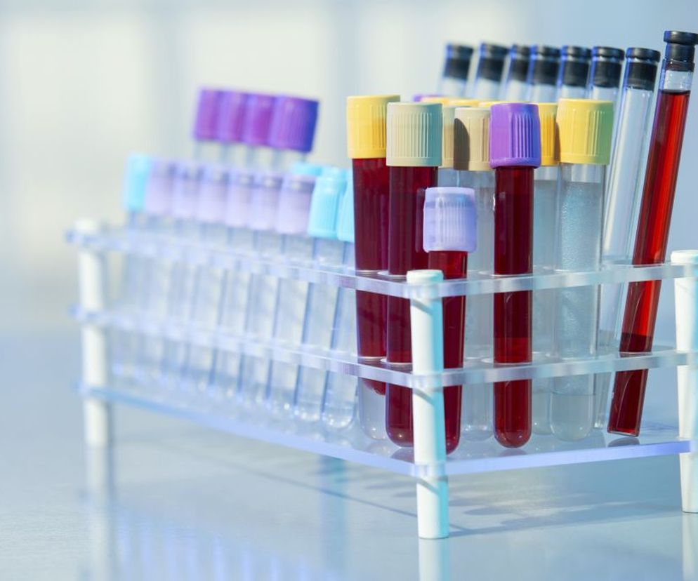 Fosfataza zasadowa (Falk, FAL, FZ, fosfataza alkaliczna ALP) to jeden z parametrów w badaniu biochemicznym.