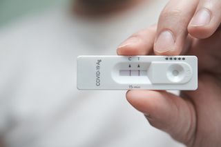 Ponad 750 dni z COVID-19. Naukowcy opisali najdłuższą znaną infekcję
