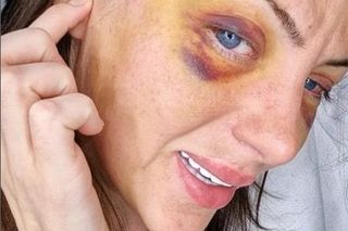 Nie żyje Ludzka Barbie! 31-letnia influencerka znaleziona martwa w mieszkaniu!